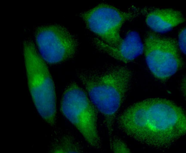 14-3-3 &epsilon; Rabbit mAb
