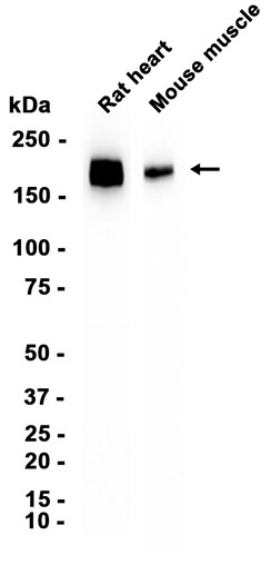 Phospho-PDGF Receptor beta (Tyr740) (YD13094) Rabbit mAb