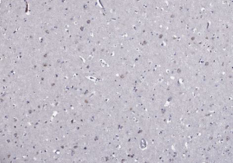 Collagen II Rabbit mAb