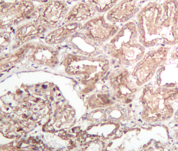 VEGFA Rabbit mAb