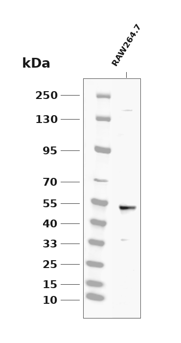 Phospho-RIP3 (Ser232) (YD19088) Rabbit mAb
