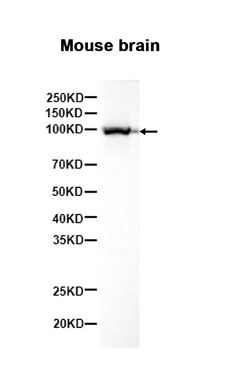 ALDH1L1 Rabbit mAb
