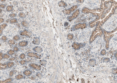 Interferon gamma (YD15388) Rabbit mAb