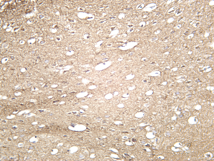 Amyloid &beta; A4 (Phospho-Thr743/668) Antibody