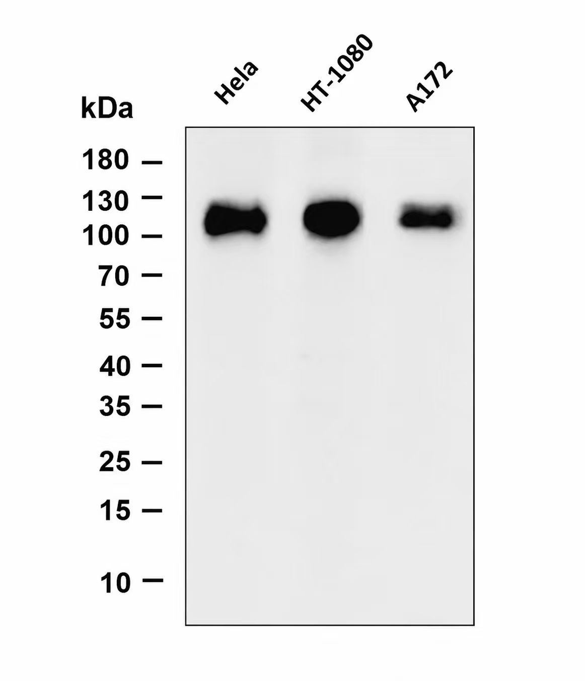 LAMP1 Rabbit mAb