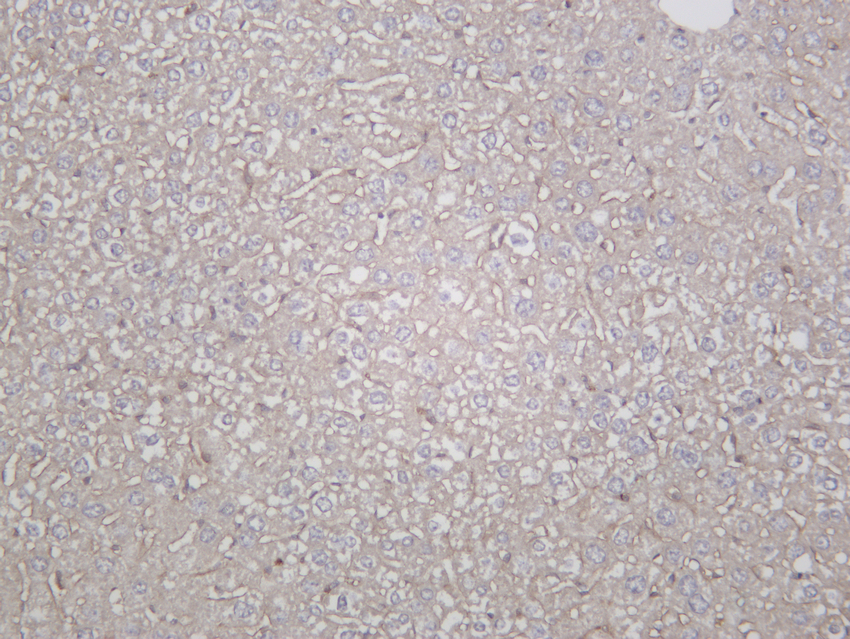 LAMP2 Rabbit mAb