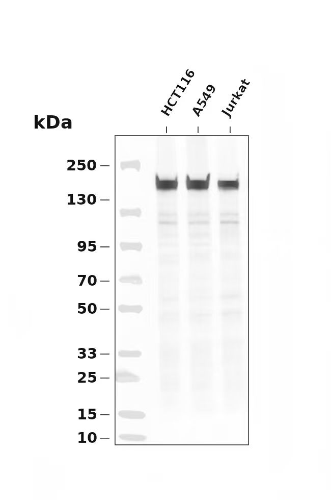 VEGF Receptor 1 Rabbit mAb