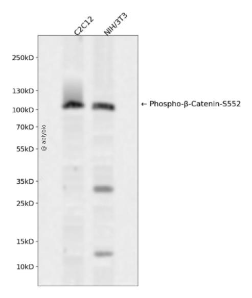 Phospho-beta Catenin (Ser552) pAb