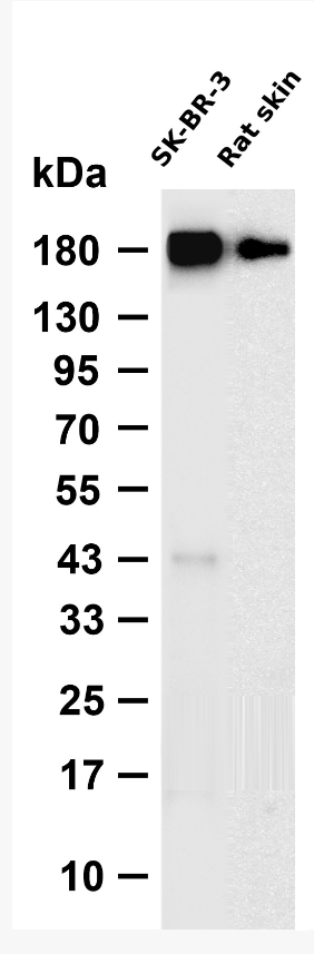 ErbB-3 Rabbit mAb