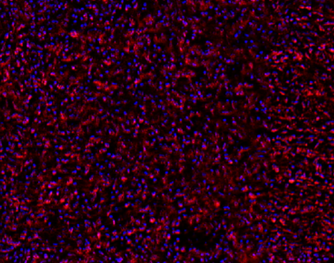 PDGFR-&beta; Rabbit mAb