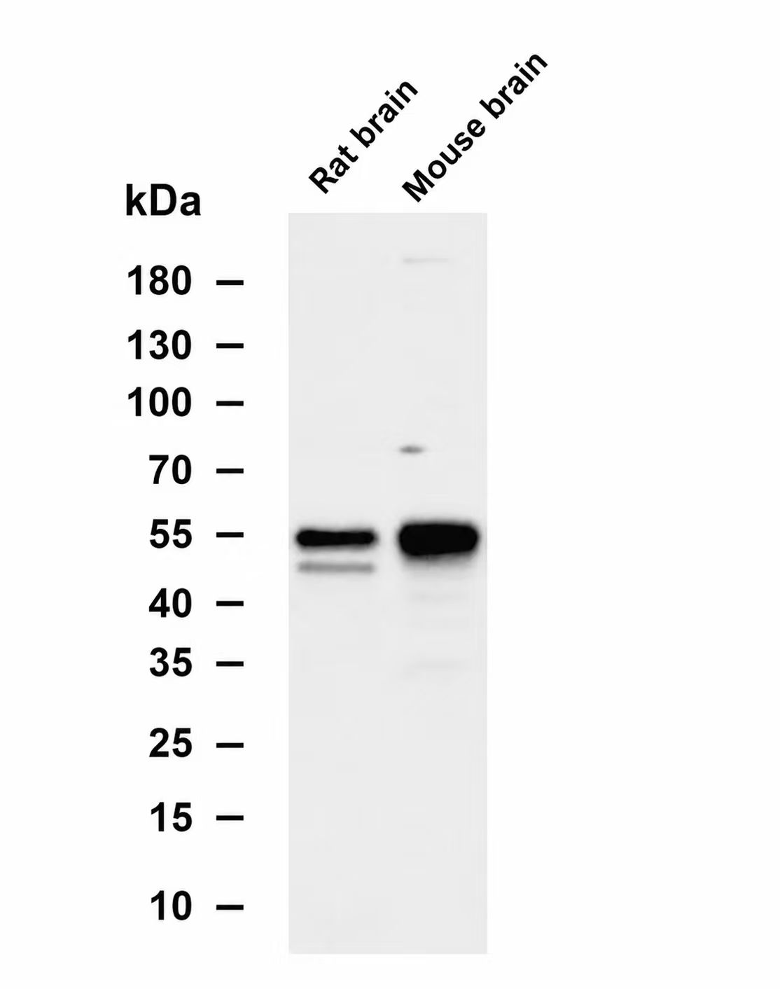 CaMKII &alpha; Rabbit mAb