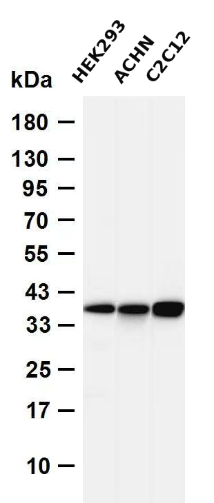 AMPK&beta;1  Rabbit mAb