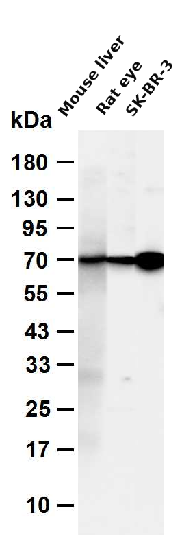 EAAT2 (YD14250) Rabbit mAb