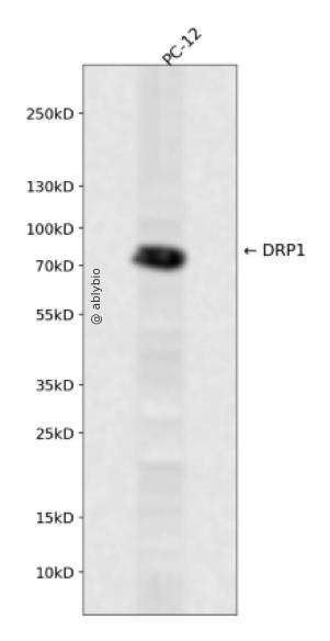 Phospho-DRP1 (Ser637) pAb
