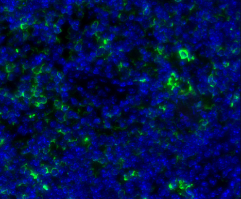 CD86 Rabbit mAb