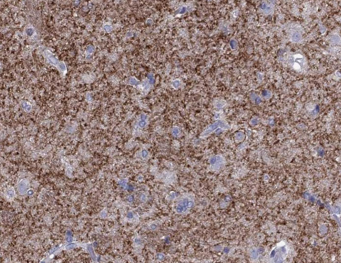 Adenosine receptor A2a (YD34393) Rabbit mAb
