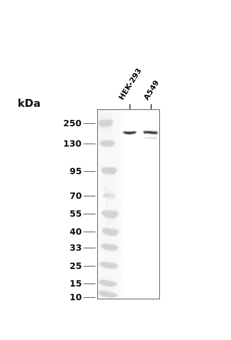 RB1CC1 Rabbit mAb