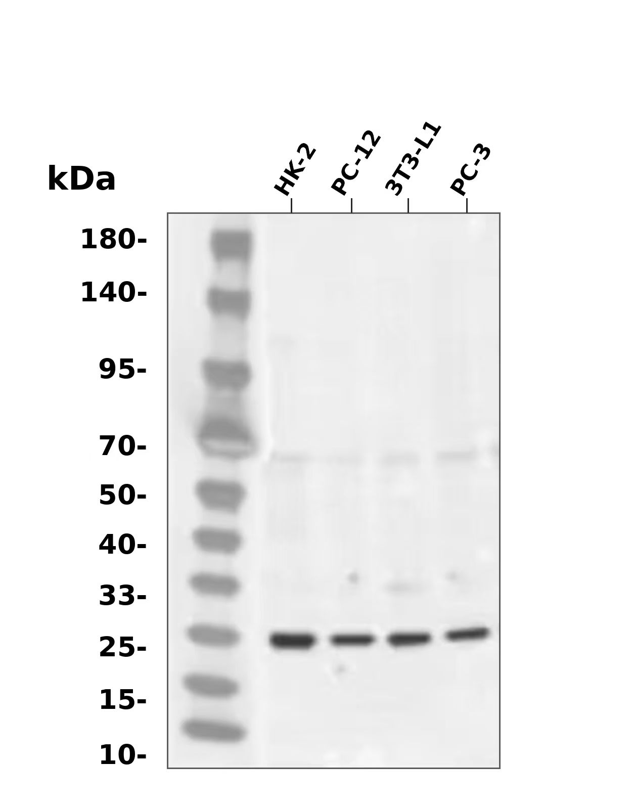 Peroxiredoxin 1 Rabbit mAb
