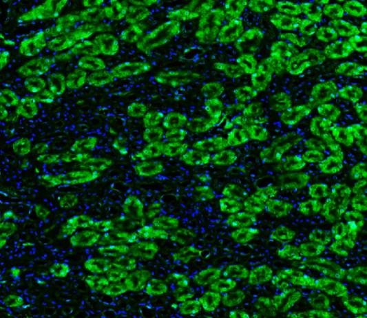 NQO1 Rabbit mAb