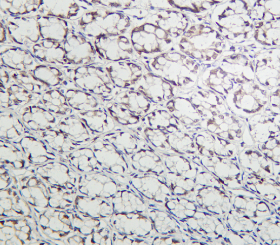Cyclin E1 Rabbit mAb