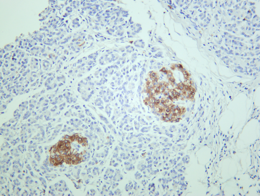 MAP2 (YD20476) Rabbit mAb