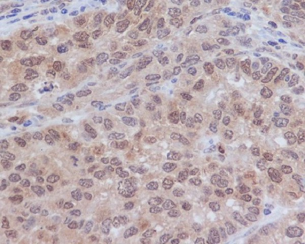 Phospho-ERK1/2 (Thr202+Tyr204/Thr185+Tyr187) pAb