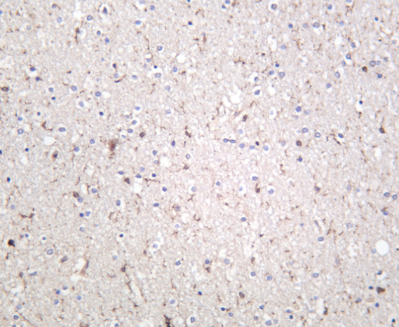 VEGFA Rabbit mAb