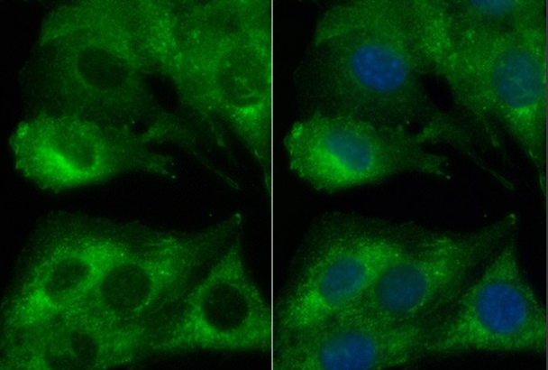 PDGFR beta (YD18153) Rabbit mAb
