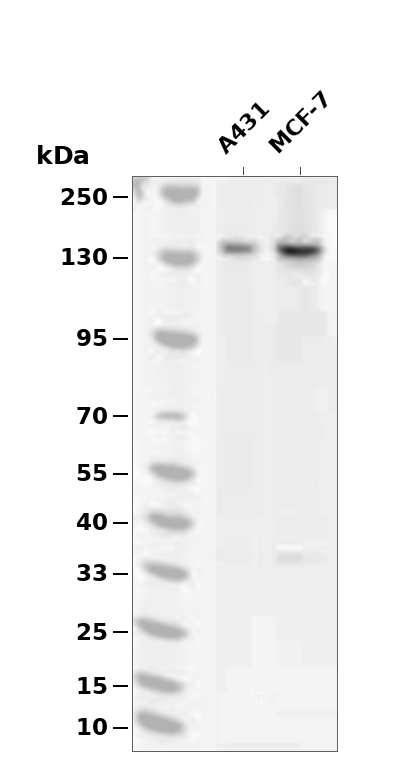 IGF1R/Insulin Receptor (Phospho-Thr1375) Antibody