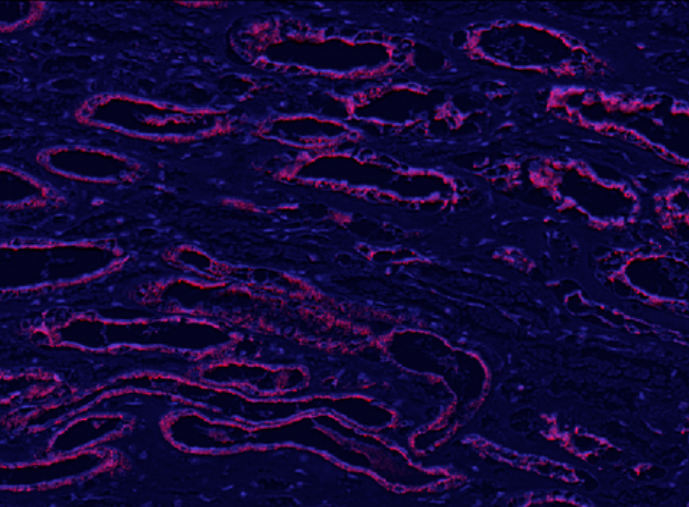 LAMP1 Rabbit mAb