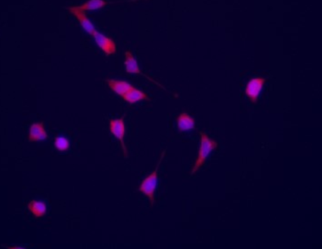 VEGF Receptor 1 Rabbit mAb
