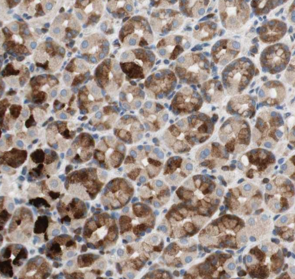 PI3-kinase p85-&alpha; (Phospho-Tyr607) Antibody
