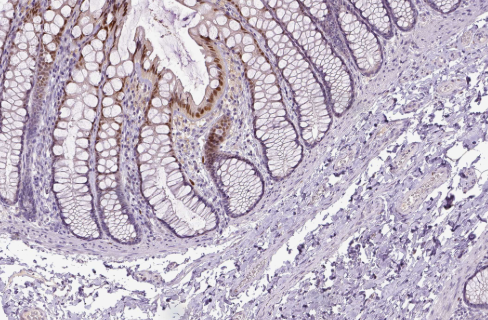 p21 Rabbit mAb