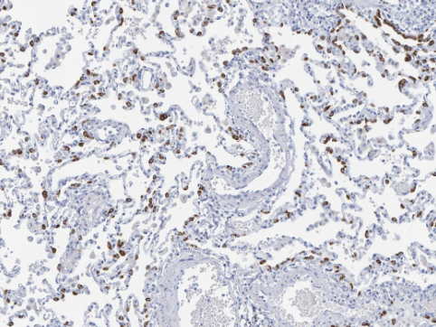 SFTPC (YD31972) Rabbit mAb