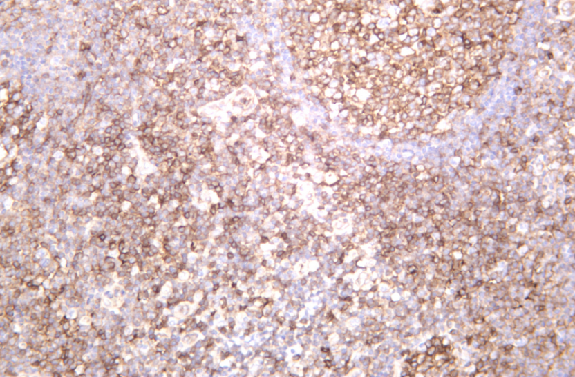 Fas Rabbit mAb