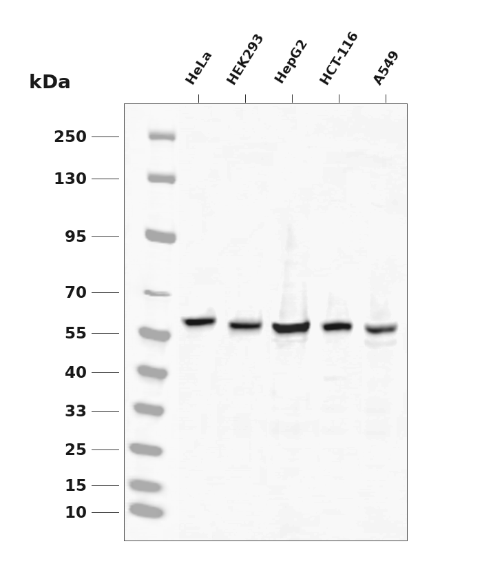 XIAP Rabbit mAb