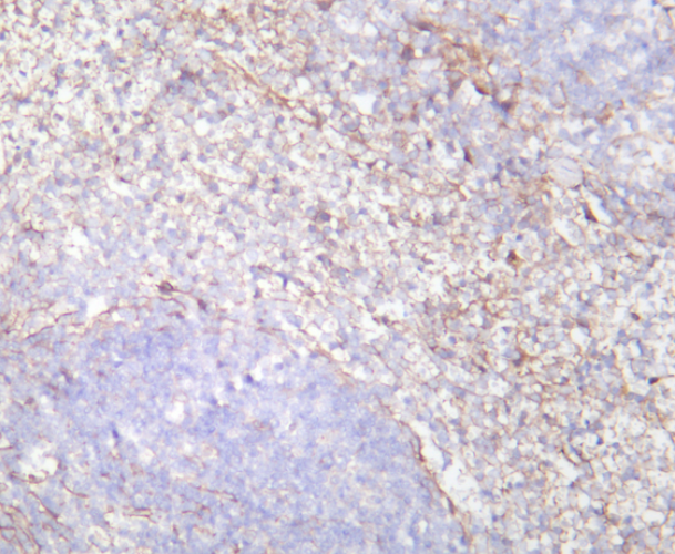 PDGFR-&beta; Rabbit mAb