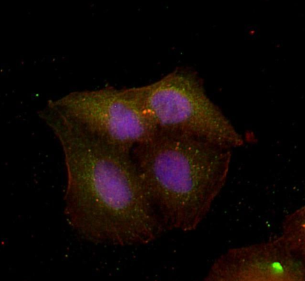 ABCG1  Rabbit mAb，staining A549 cells