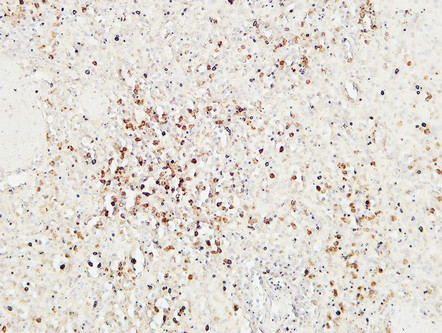 Granzyme B (YD11356) Rabbit mAb