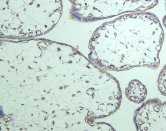 VEGF Receptor 2 Rabbit mAb