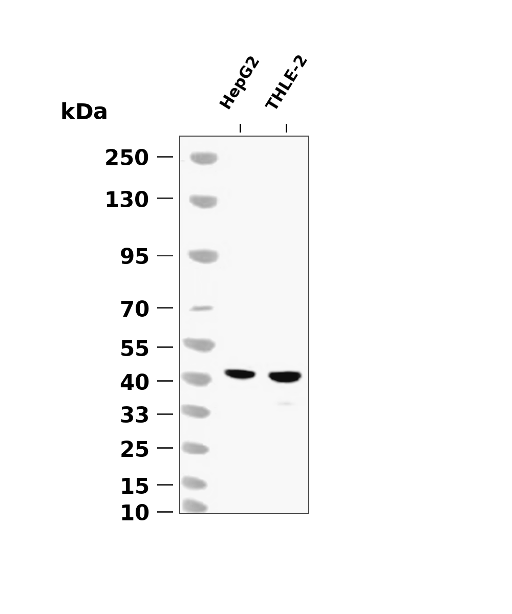 ASGR1 (YD20469) Rabbit mAb