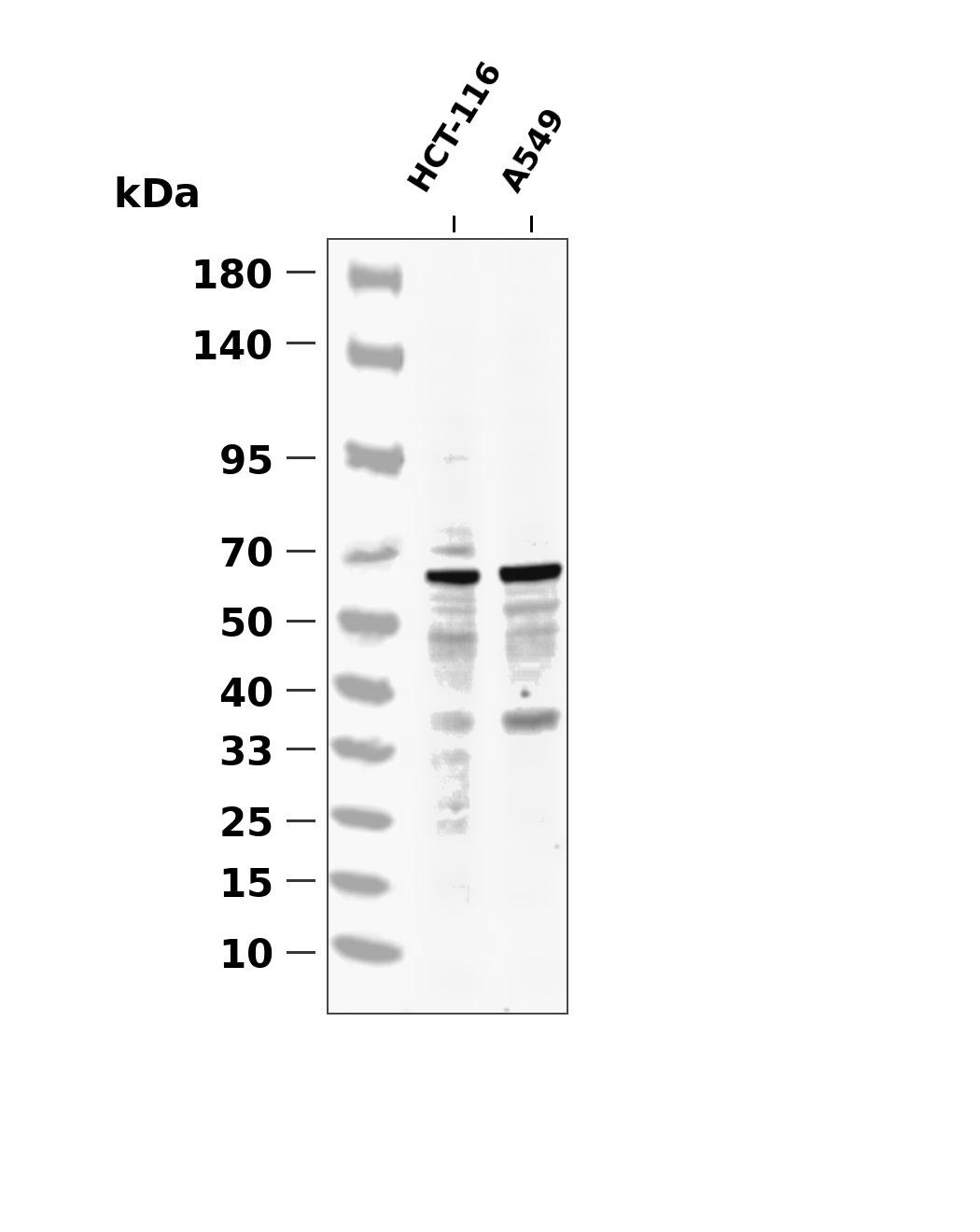 PAK1/2/3 (Phospho-Thr423/402/421) Antibody