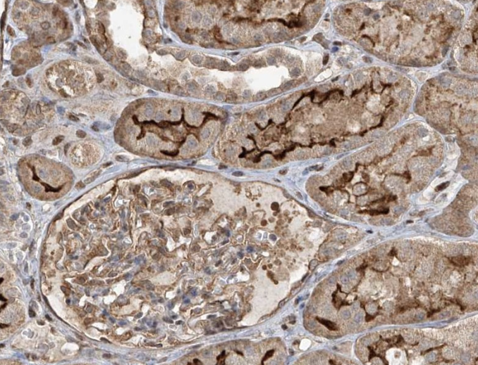 ErbB-3 (Phospho Tyr1289)  Rabbit mAb