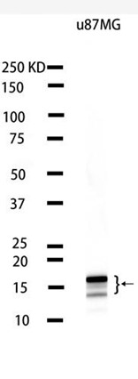 LC3B Rabbit mAb