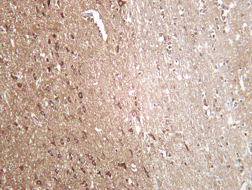 DRP1 (YD12235) Rabbit mAb