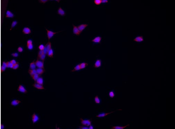 Fas Rabbit mAb