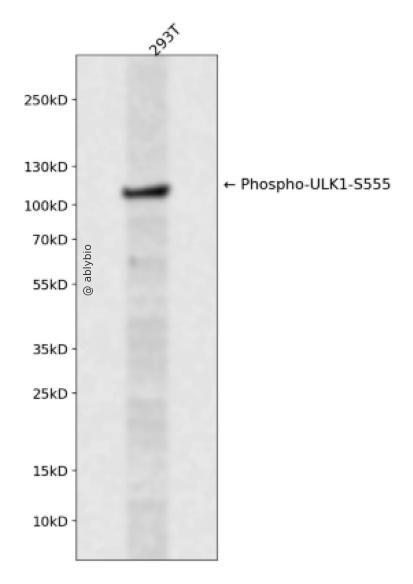 Phospho-ULK1 (Ser555) pAb