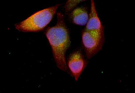 Thioredoxin  Rabbit mAb,staining hela cells