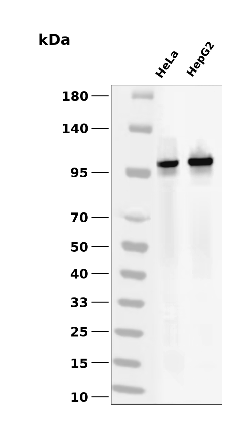 IGF-I receptor alpha (YD32099) Rabbit mAb