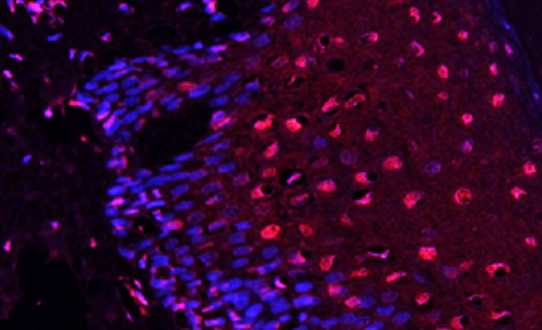 p21 Rabbit mAb